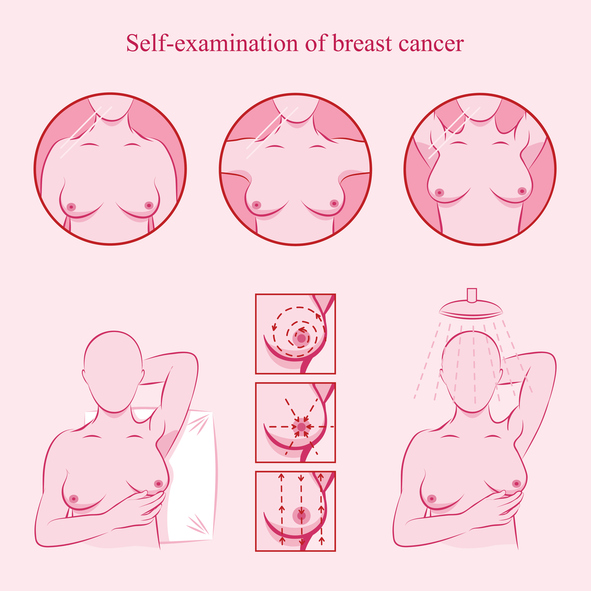 Self examination of breast cancer