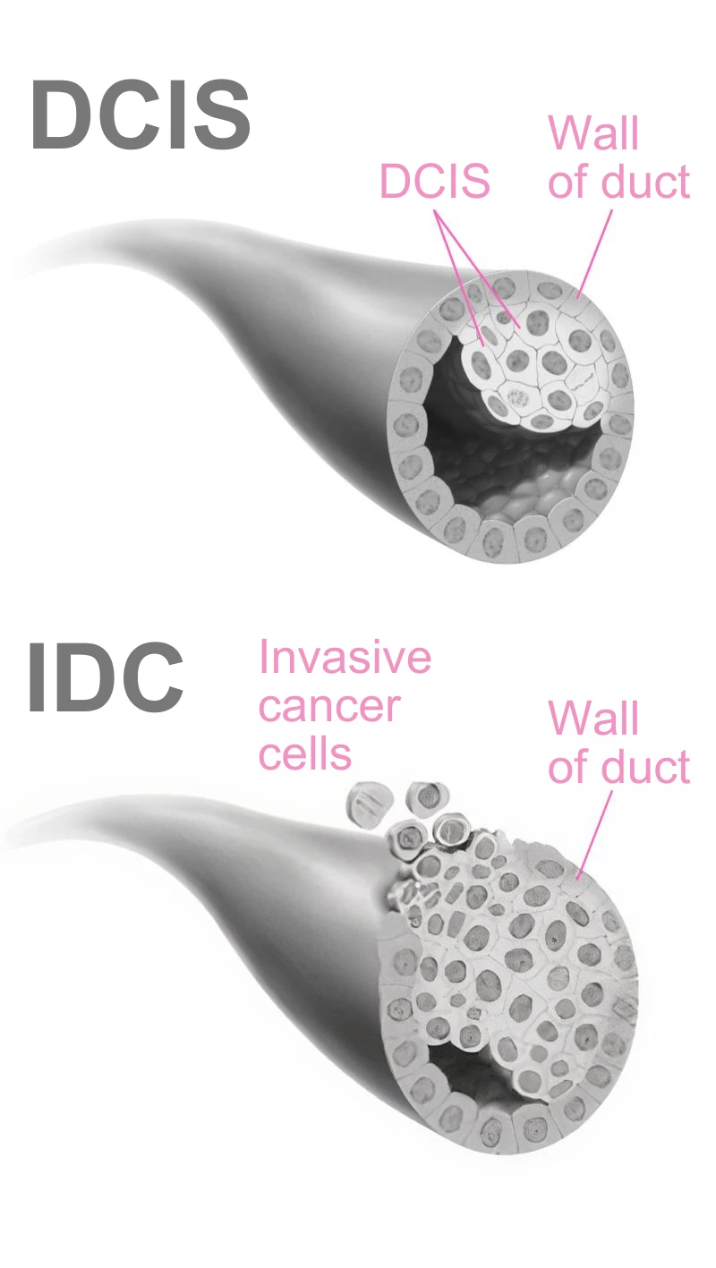 anatomy of the breast