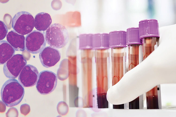 leukaemia virus under microscope and blood test tubes in a rack