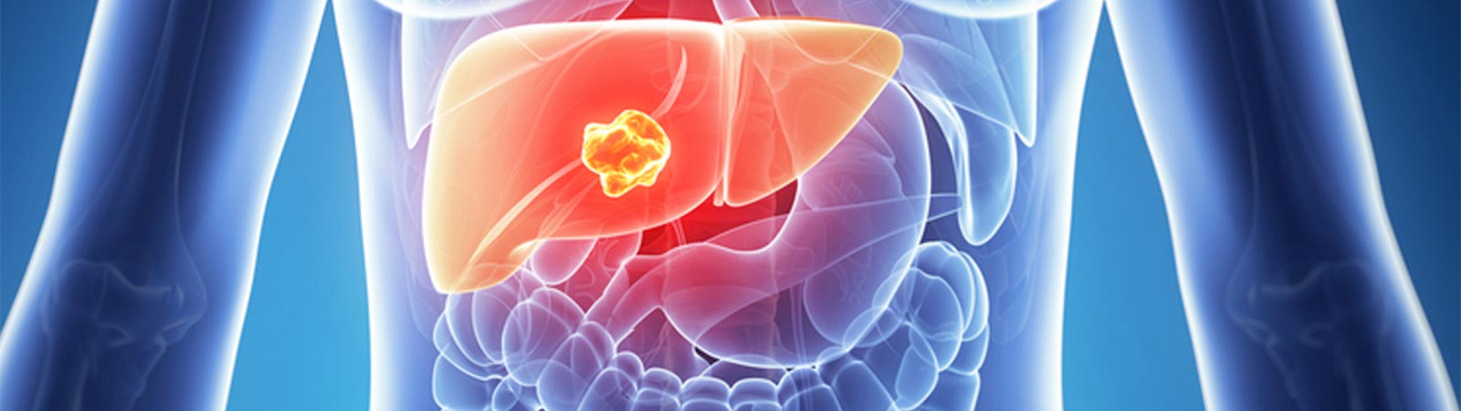 close up image of liver tumor x ray
