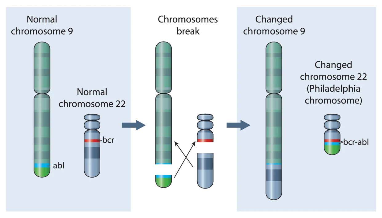 gene mutation of a normal chromosone into Philadelphia chromosone