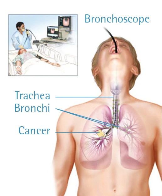 doctor performing a bronchoscopic examination on patient