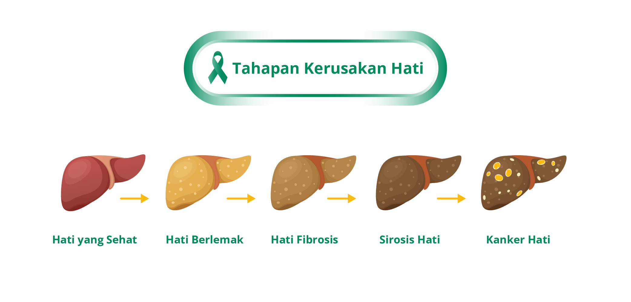 Stages of Liver Damage