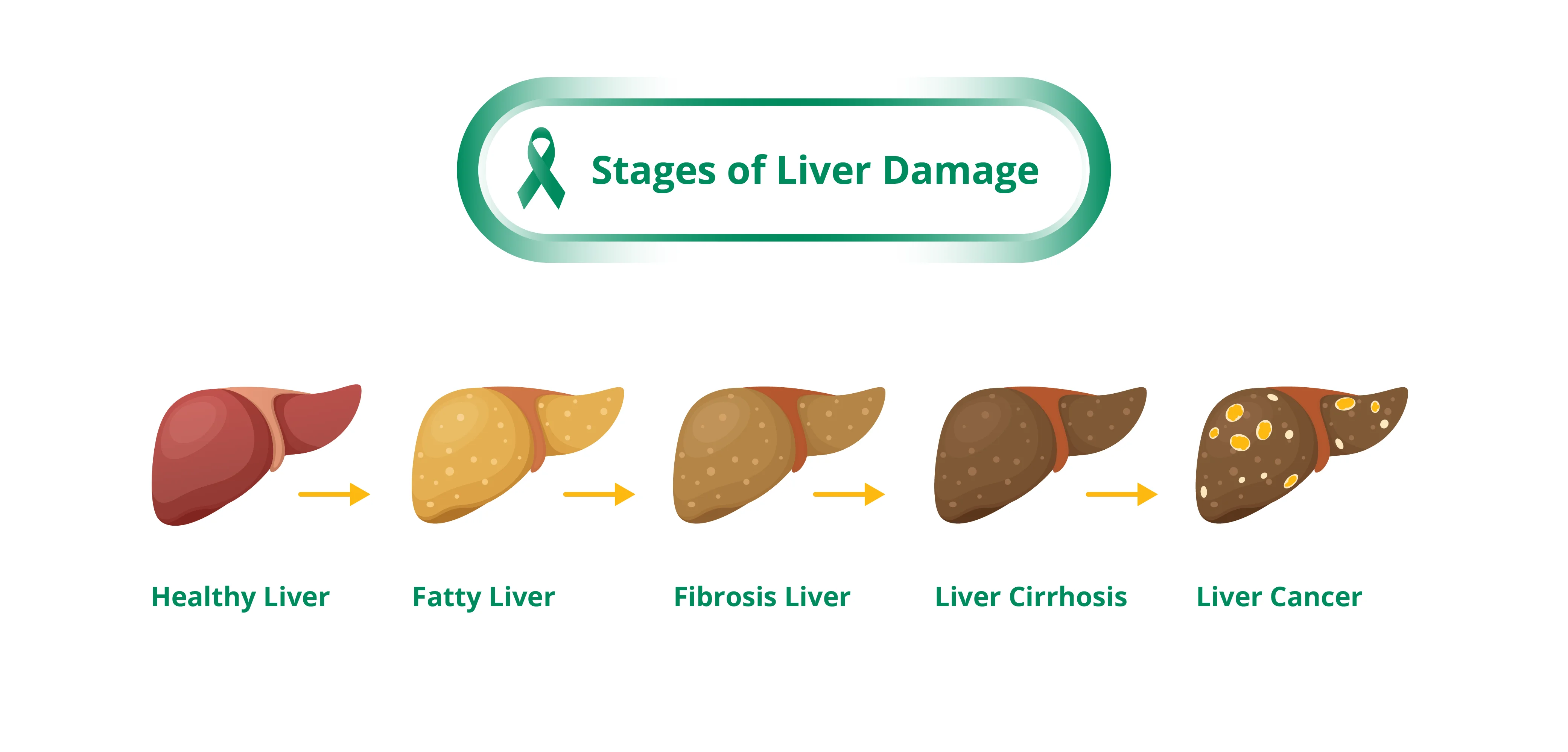 Stages of Liver Damage