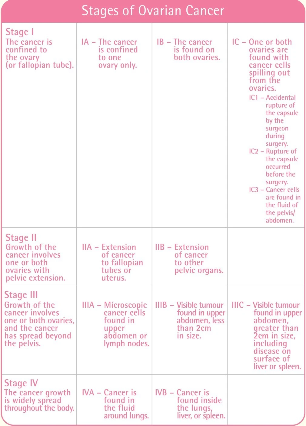 table showing 4 stages of ovarian cancer