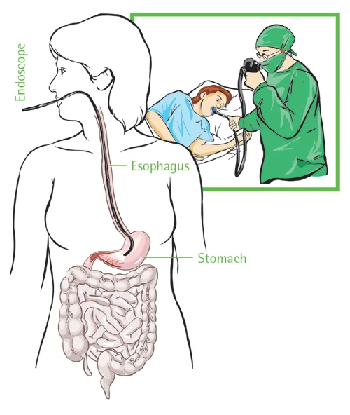doctor performing a gastroscopy examination on patient