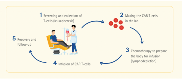 CAR T细胞疗法：工作原理