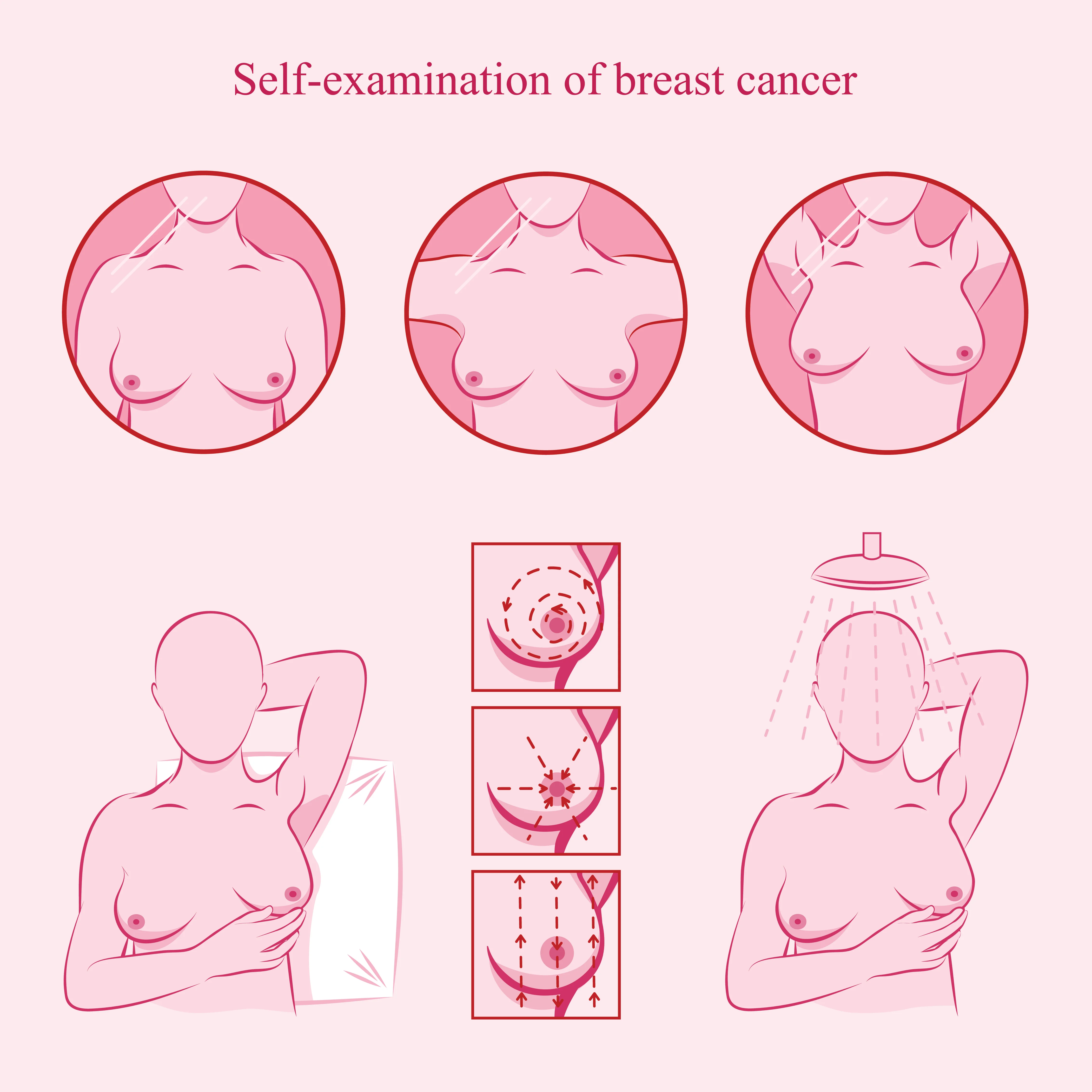 Breast Cancer Screening: Why Bother?