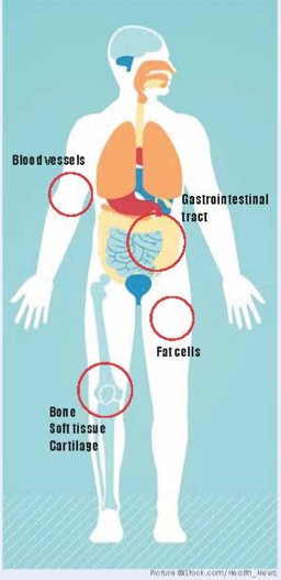 Sarcomas - A complex disease