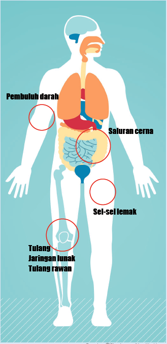 Tentang Sarkoma - Diagnosis & Pengobatan